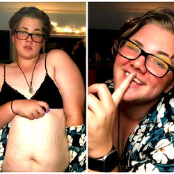 🍓Strawberry 🍓 photo