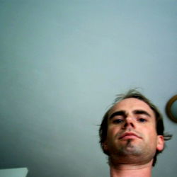 Person with balding spots, smiling at camera