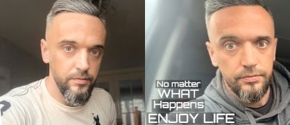 Alex | The Only One | 🏴󠁧󠁢󠁥󠁮󠁧󠁿 🇷🇴 photo