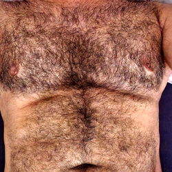Amok Khan's Chest Hair Display