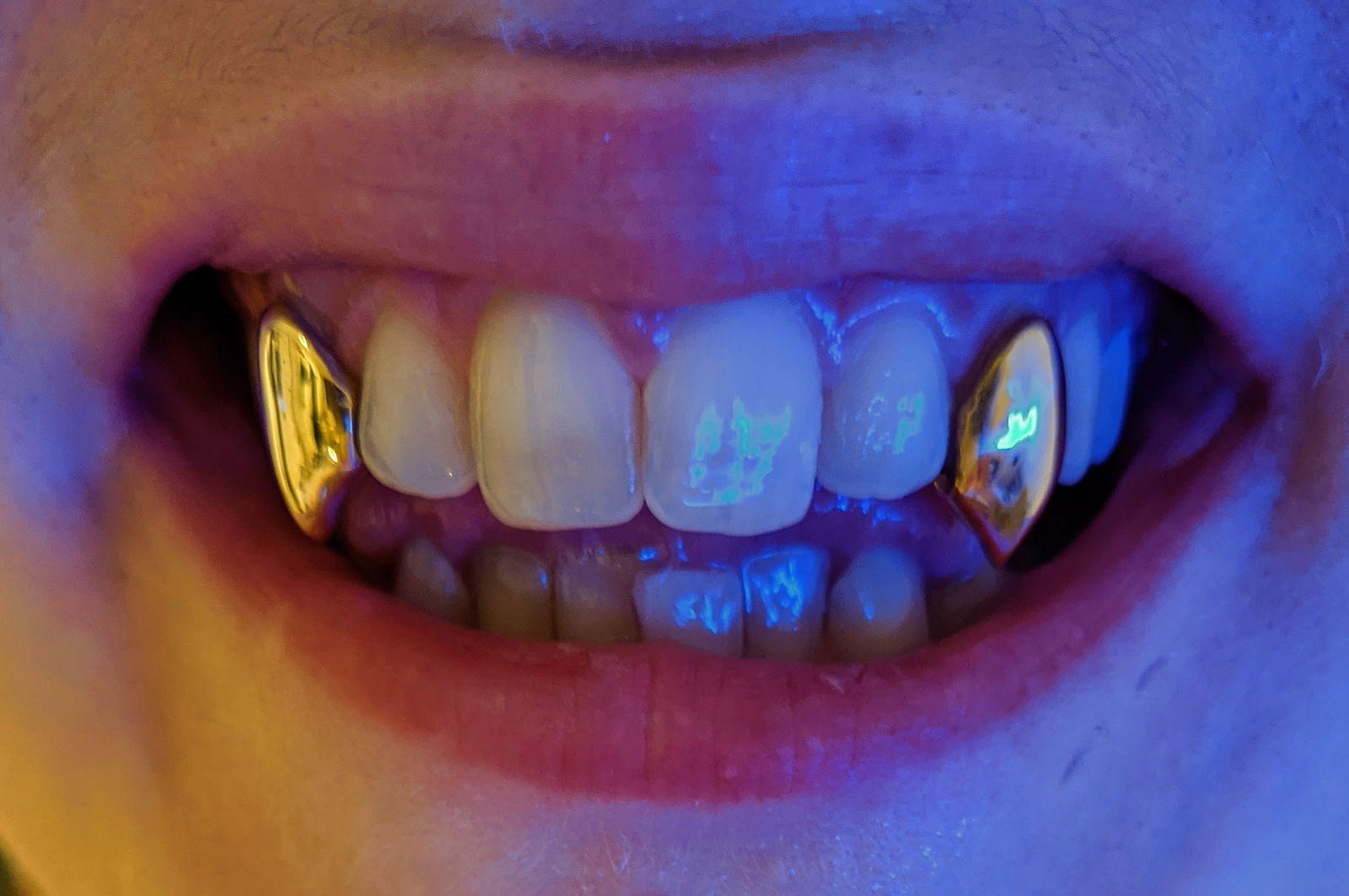 ⚡mysterymullet⚡ photo