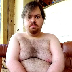 Young Man with Balding