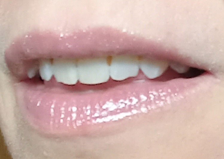 🌱Ada-Sofia FREE photo