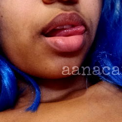 Hot Aninha 🔥 photo