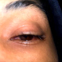 Close-up of a person's eye