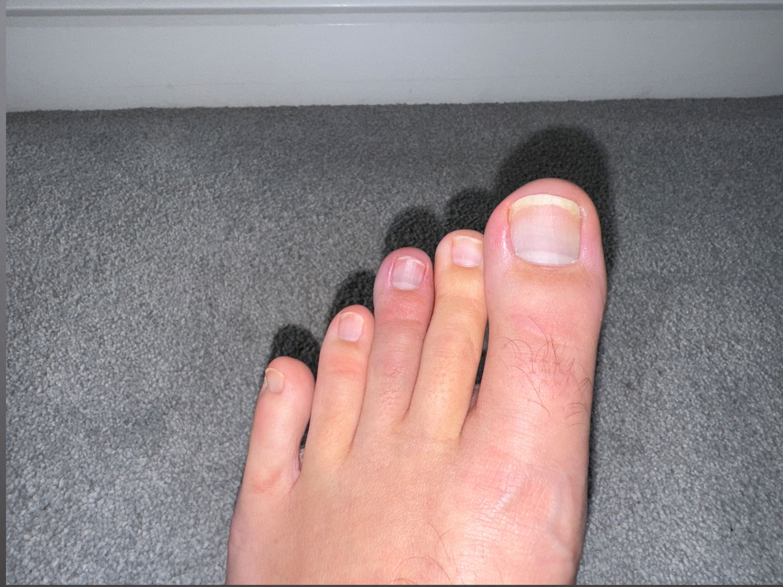 Nice Long Toes photo