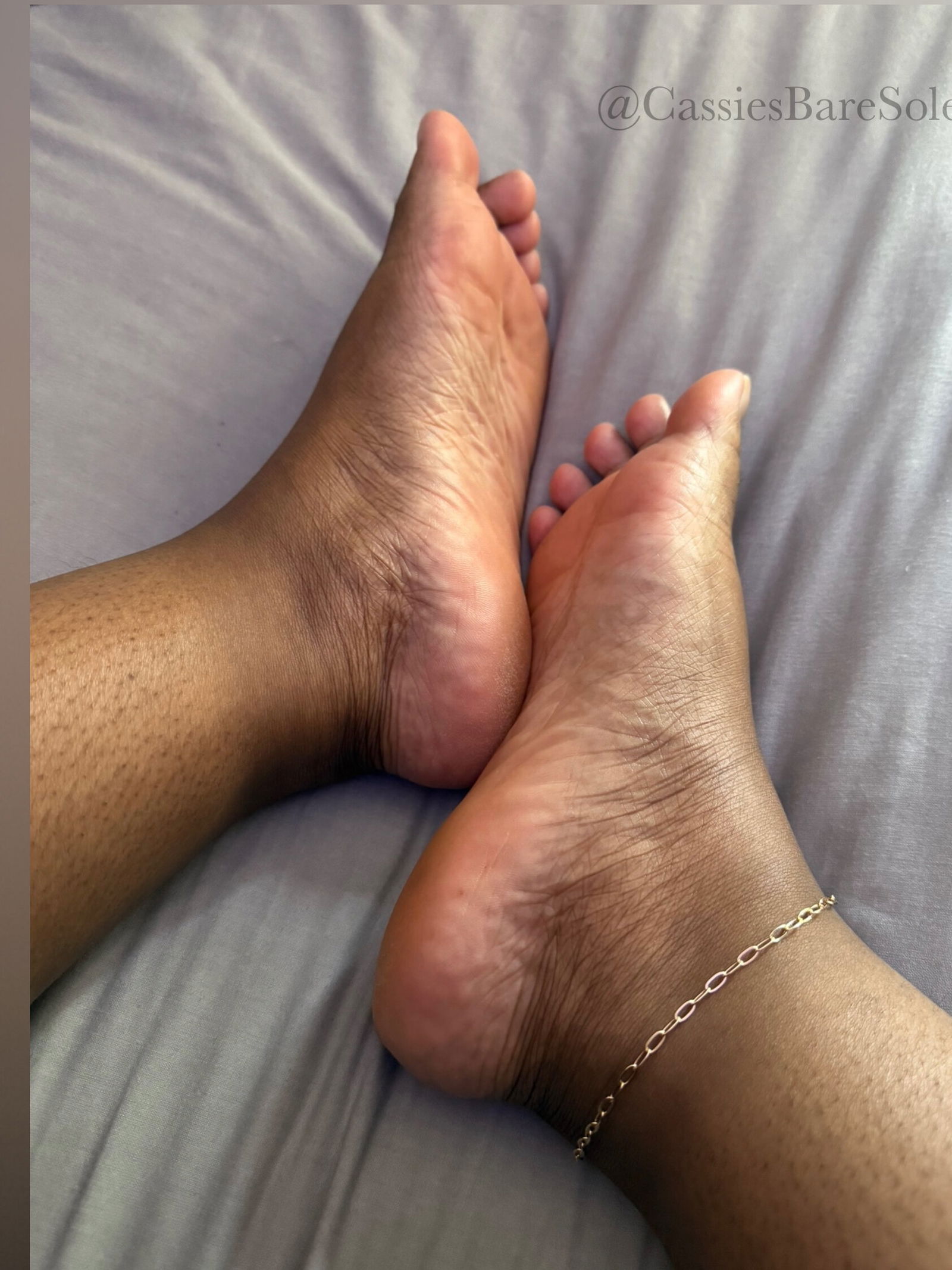 Cassie’s Sole🦶🏾🧚🏾‍♀️ photo