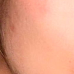 Aesthetically Pleasing Facial Features with a Soft Lighting