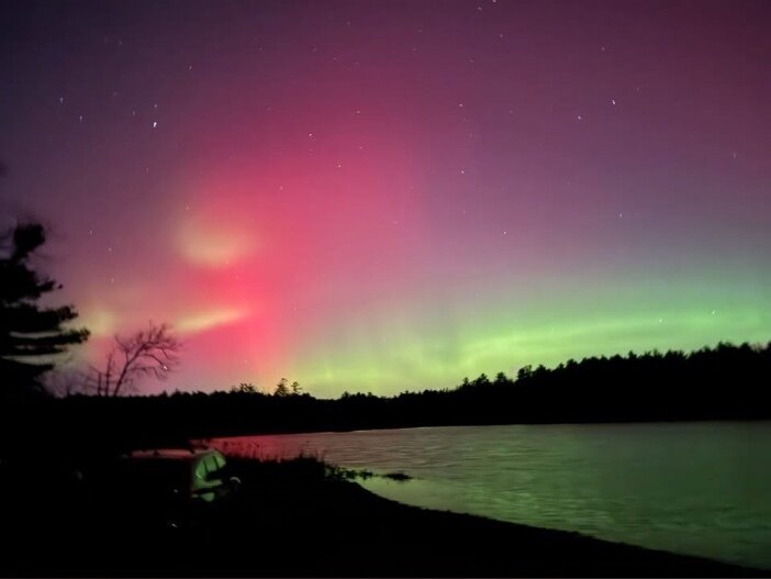 Patient 666158 photo