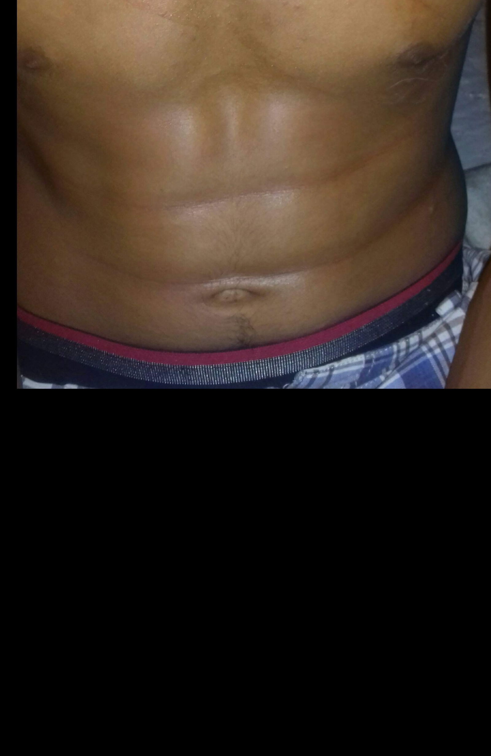 alejandro restrepo photo