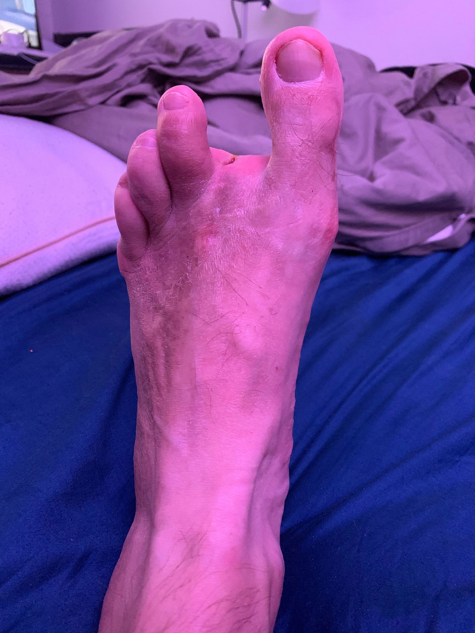 Andy’s strange foot photo