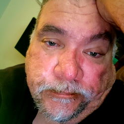 A Man Resting His Head on His Hand