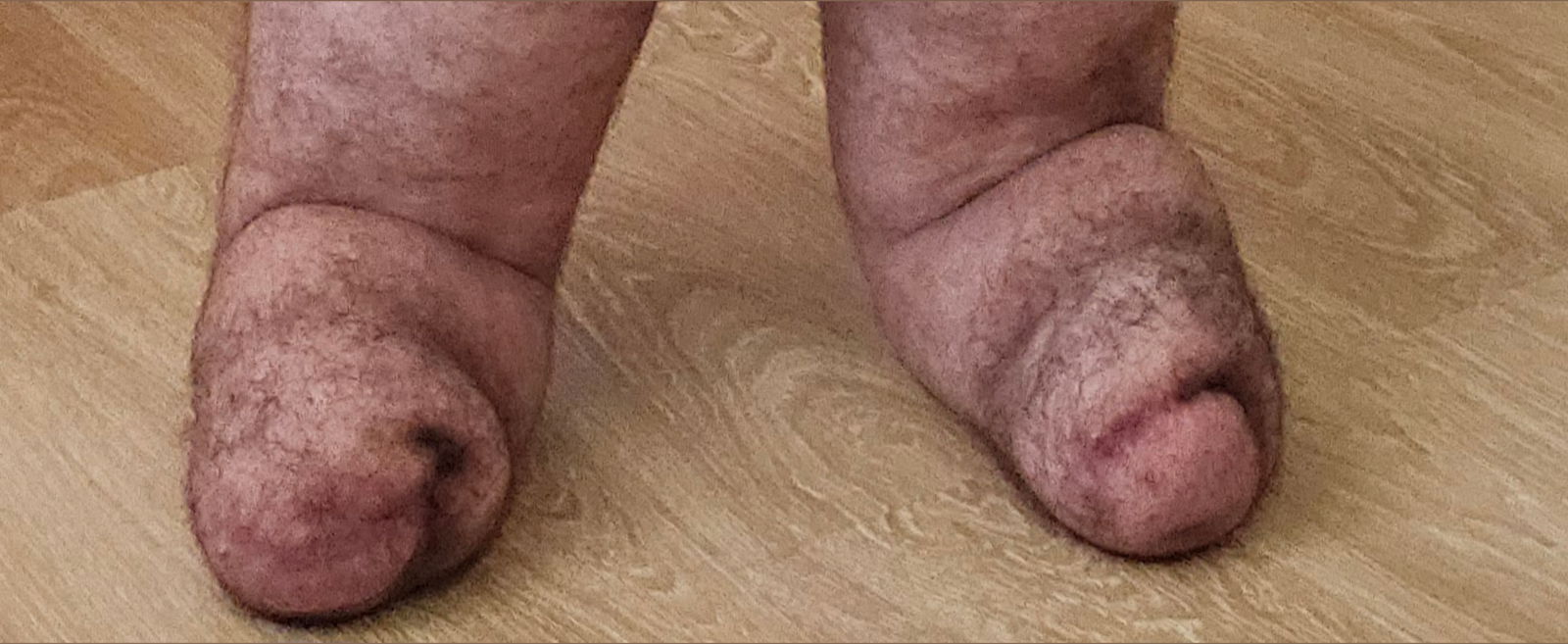 Amputee pup🍆🦿🦿 photo