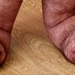 Amputee pup🍆🦿🦿 photo