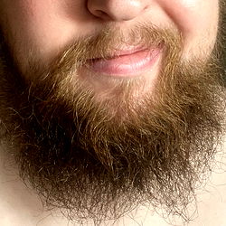 Bearded Man with Facial Hair