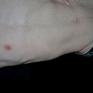 ๐ฎ๐๐๐๐๐๐๐๐ ๐ฑ๐๐๐๐๐๐ photo