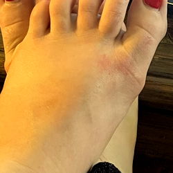 Jamie's Toes: A Close-Up View