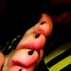 Ash Feet: Toe-tastic Trend or Foe to Your Feet?