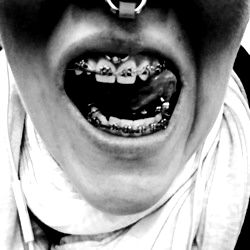 Teethshow photo