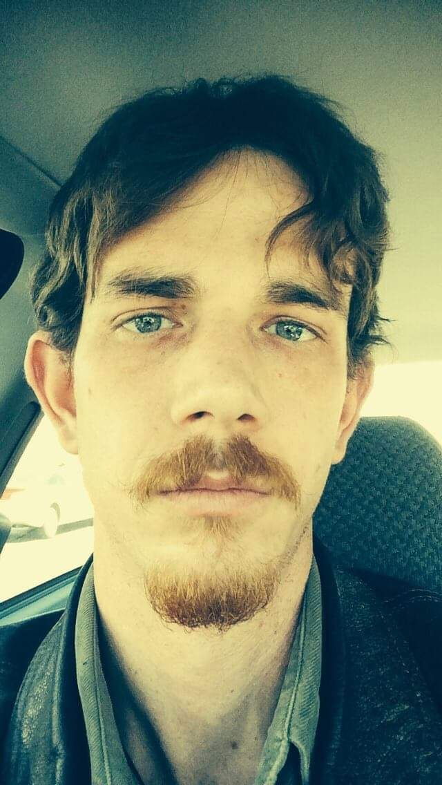 Penectomized_anon photo