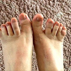 WebbedFeetRita photo