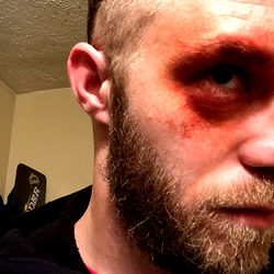Bearded Man with Black Eye and Paint Splatters on Hair, Dirtstyle