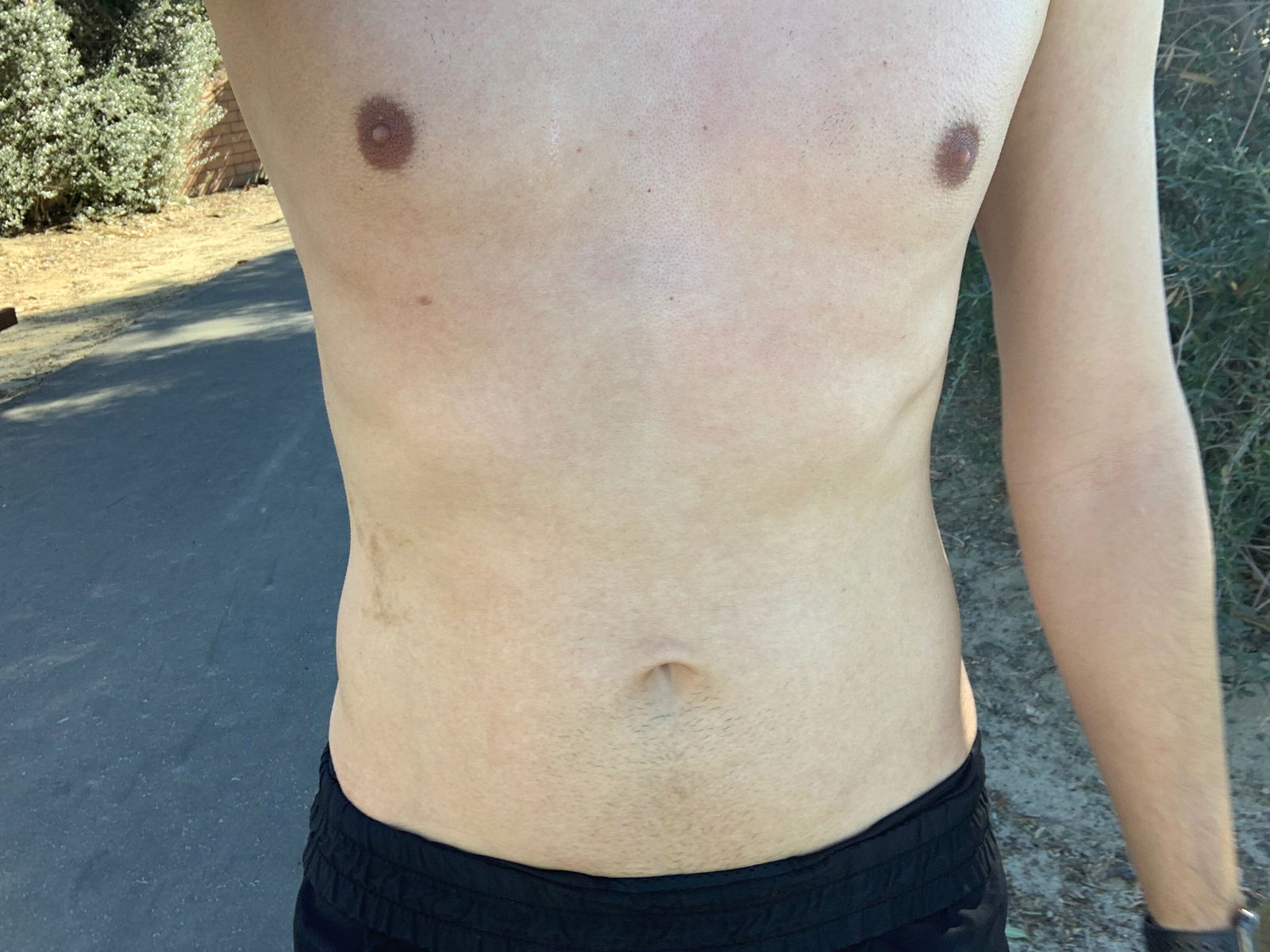 AnonymousBreedings30 photo