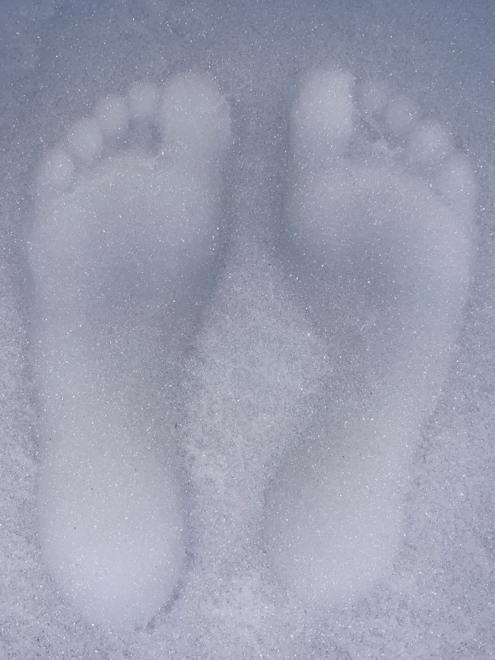 Ally’s 🦶🏻 💀 photo