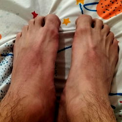 Foot Pain: Common Causes and Prevention