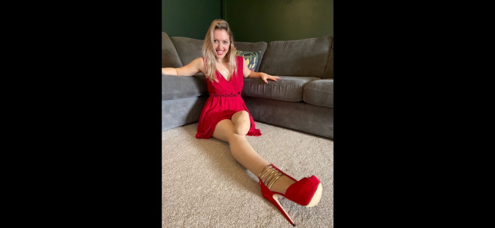 Amputee Bee VIP photo