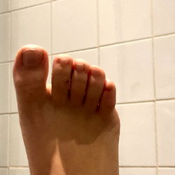 Intimate Foot Details: ÁEfrica's Toe Nail Inspection