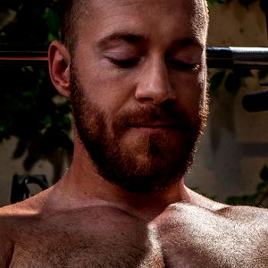 The Vitiligo Viking photo