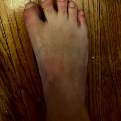 Toe-tally Distorted, Exotic American Feet with Buffalo NY Flair