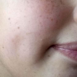 A Close-up of Anne List's Facial Features