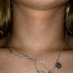 adalicia kleinn photo