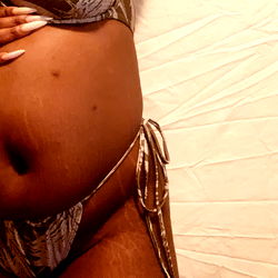 Model in AllergicR Fashion Lingerie