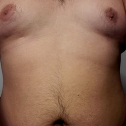 Fascinating Before & After Transformation of HorniBurrito420!