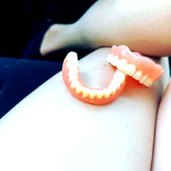 Strange Dental Implant