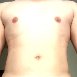 A Model Sharing His Unique Body