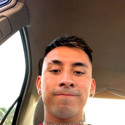 Alejandro Ramirez, 20-year-old male with red and white hair