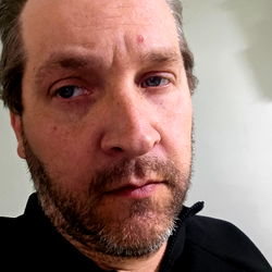 Bearded Man with Receding Hairline